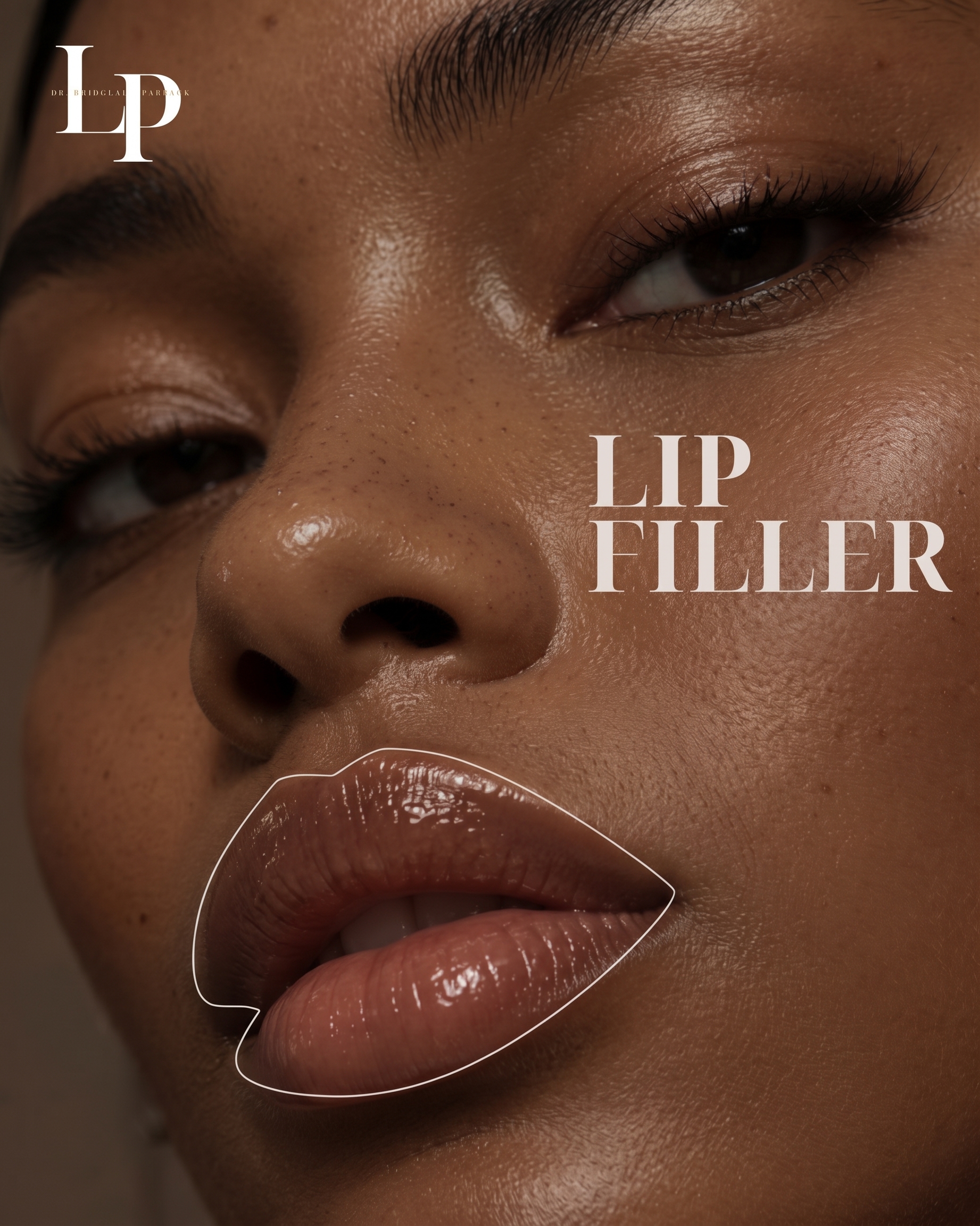 Signature Lip Filler Contouring Treatment Special